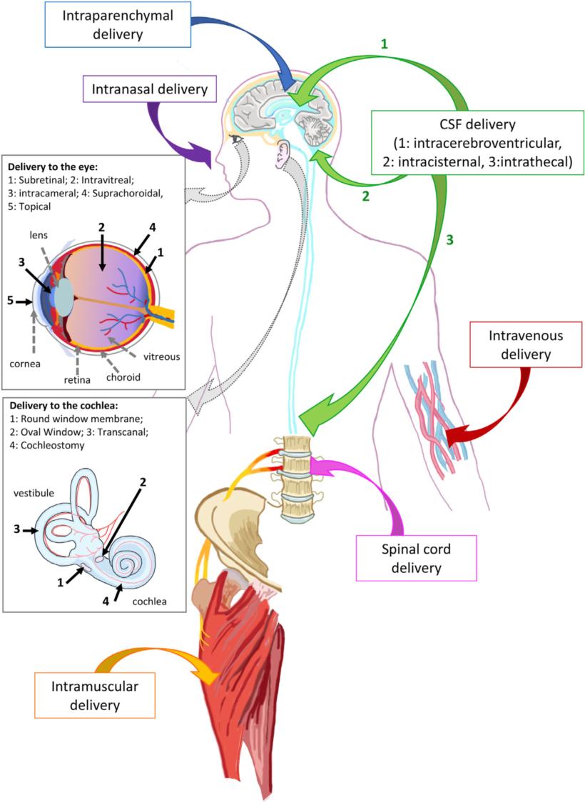 Fig 2 Pathways of AAV Delivery to the Nervous System in Vivo