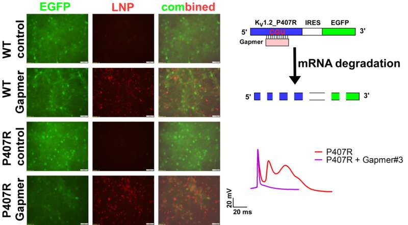 novel-gene-therapy-off