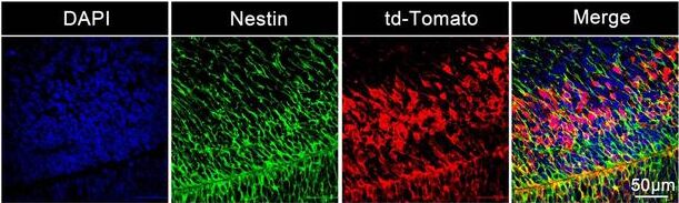 Staining of the neural stem and progenitor cells in the fetal brain transfected by Cre mRNA delivered by LNPs